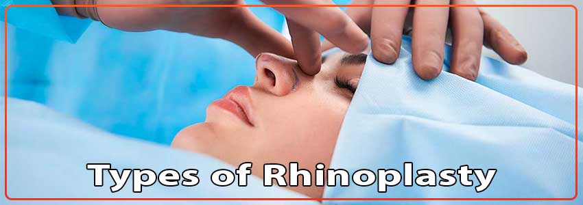 Types-of-Rhinoplasty