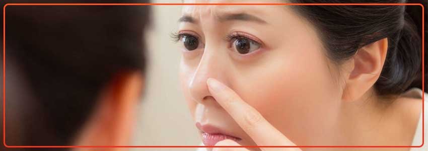 best-face-wash-for-whiteheads-on-nose