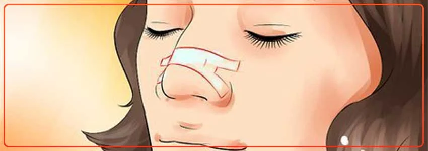 DIY-breathe-right-strips