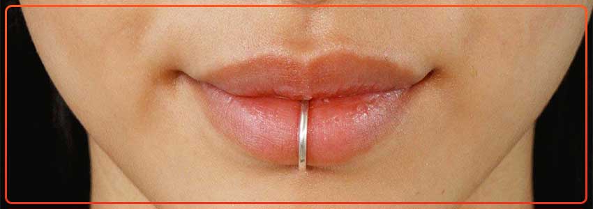 Infected Lip Piercing: Causes, Symptoms, And Treatment