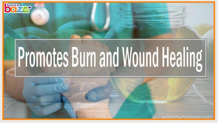 Promotes Burn and Wound Healing